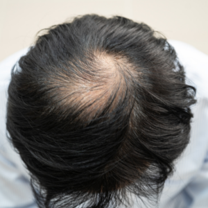 hair supplements for men